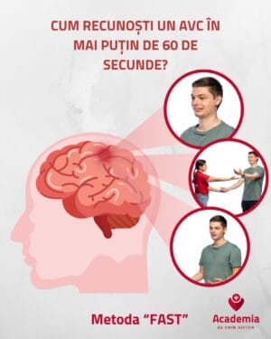 Cum să recunoști un AVC în mai puțin de un minut Cum să recunoști un AVC în mai puțin de un minut
