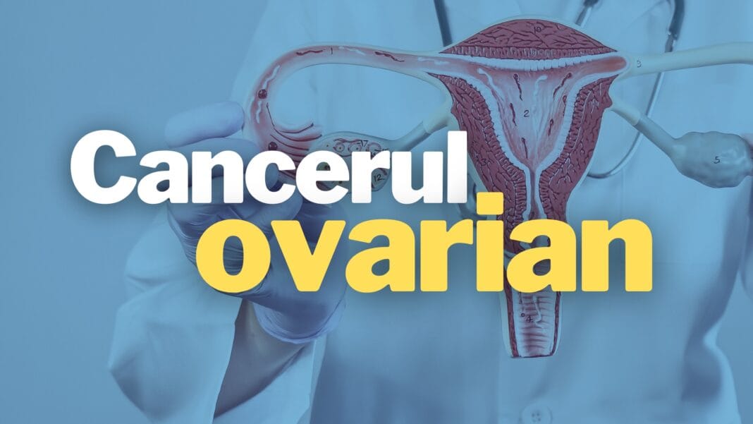 Fiecare femeie contează în fața cancerului ovarian! Fiecare femeie contează în fața cancerului ovarian!